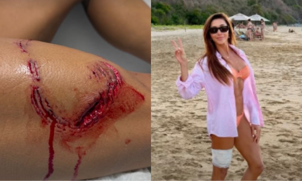 Turista é mordida por tubarão durante mergulho em Fernando de Noronha